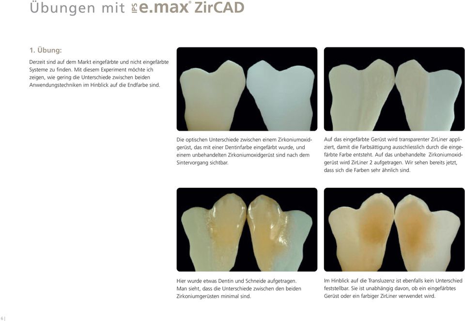 Die optischen Unterschiede zwischen einem Zirkoniumoxidgerüst, das mit einer Dentinfarbe eingefärbt wurde, und einem unbehandelten Zirkoniumoxidgerüst sind nach dem Sintervorgang sichtbar.