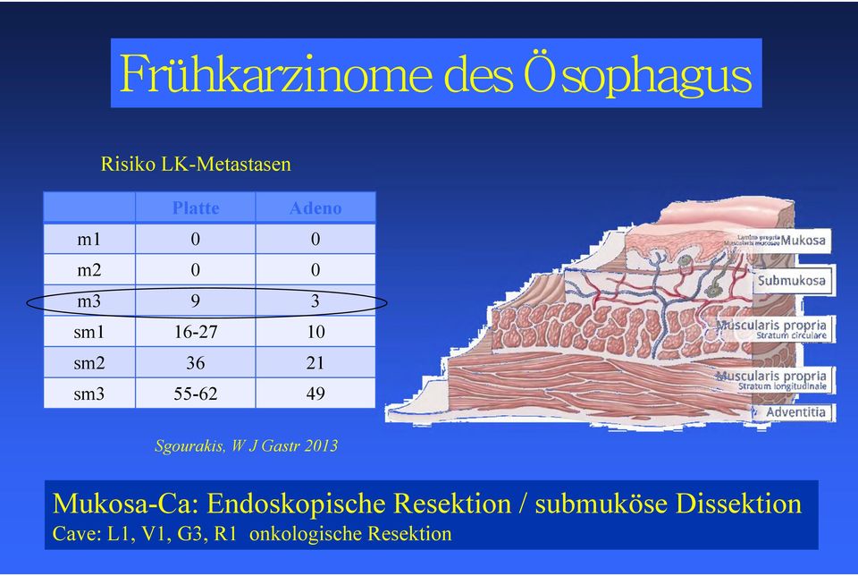 Sgourakis, W J Gastr 2013 Mukosa-Ca: Endoskopische Resektion