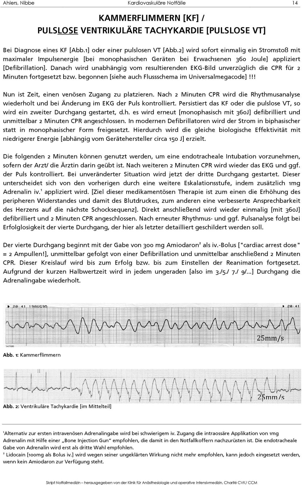Danach wird unabhängig vom resultierenden EKG-Bild unverzüglich die CPR für 2 Minuten fortgesetzt bzw. begonnen [siehe auch Flussschema im Universalmegacode]!