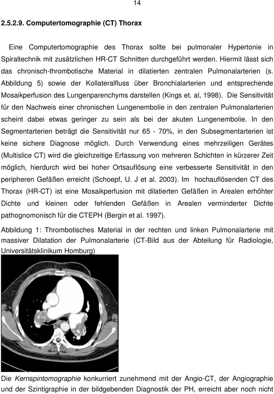 Abbildung 5) sowie der Kollateralfluss über Bronchialarterien und entsprechende Mosaikperfusion des Lungenparenchyms darstellen (Kings et. al, 1998).