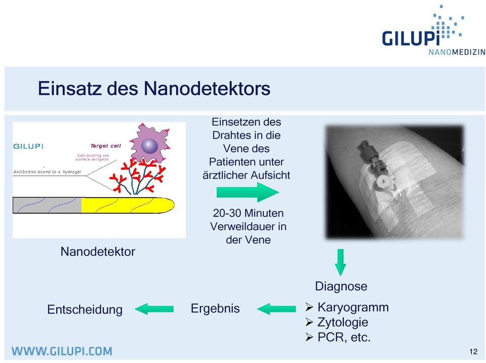 Nanodetektor 20-30 Minuten Verweildauer in der Vene