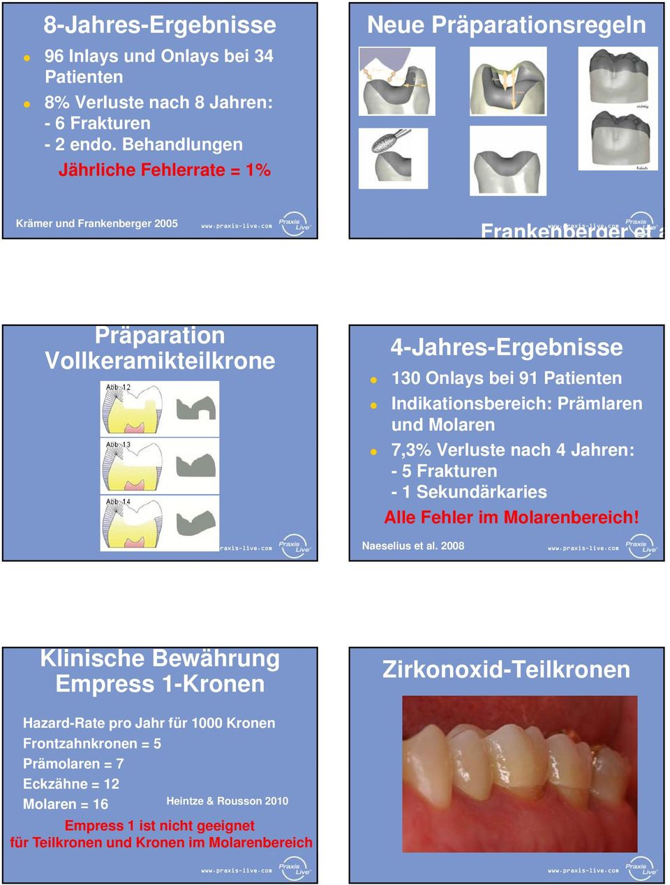 bei 91 Patienten Indikationsbereich: Prämlaren und Molaren 7,3% Verluste nach 4 Jahren: - 5 Frakturen - 1 Sekundärkaries Alle Fehler im Molarenbereich! Naeselius et al.