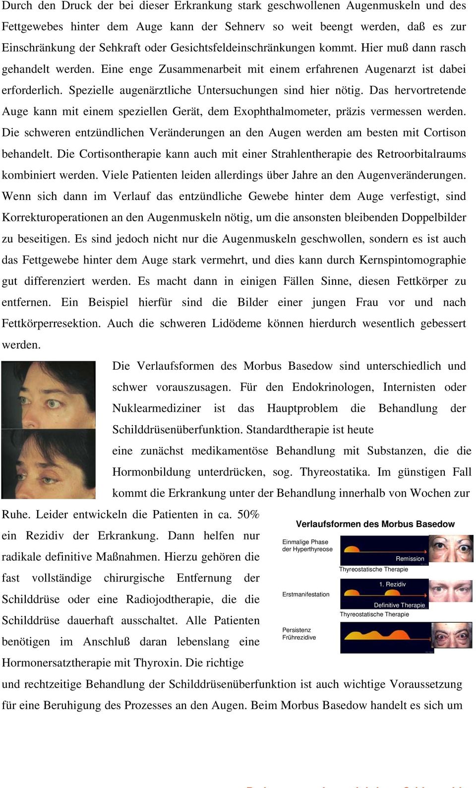 pezielle augenärztliche Untersuchungen sind hier nötig. Das hervortretende Auge kann mit einem speziellen Gerät, dem xophthalmometer, präzis vermessen werden.