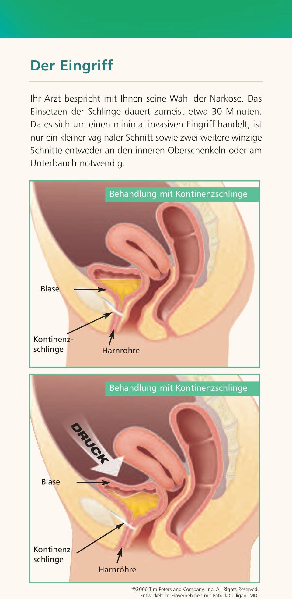 den inneren Oberschenkeln oder am Unterbauch notwendig.