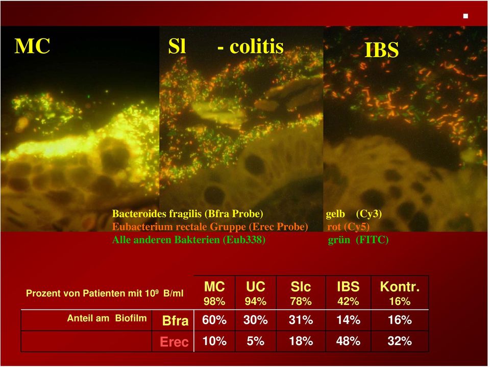 (Eub338) grün (FITC) Prozent von Patienten mit 10 9 B/ml MC 98% UC 94% Slc