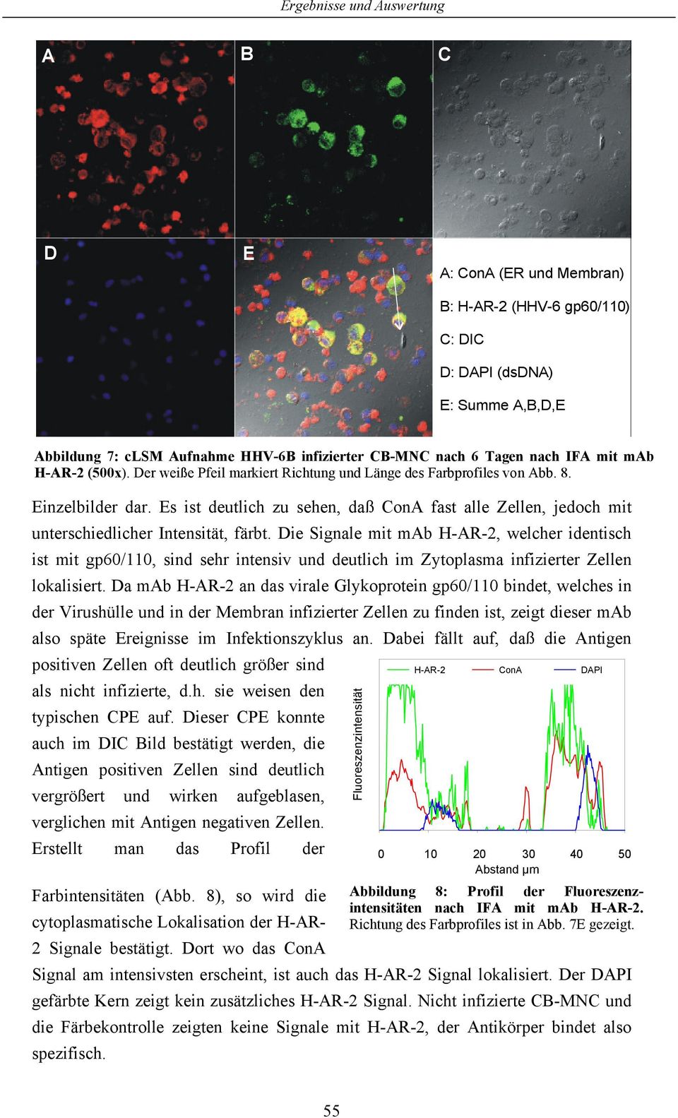 Die Signale mit mab H-AR-2, welcher identisch ist mit gp6/11, sind sehr intensiv und deutlich im Zytoplasma infizierter Zellen lokalisiert.