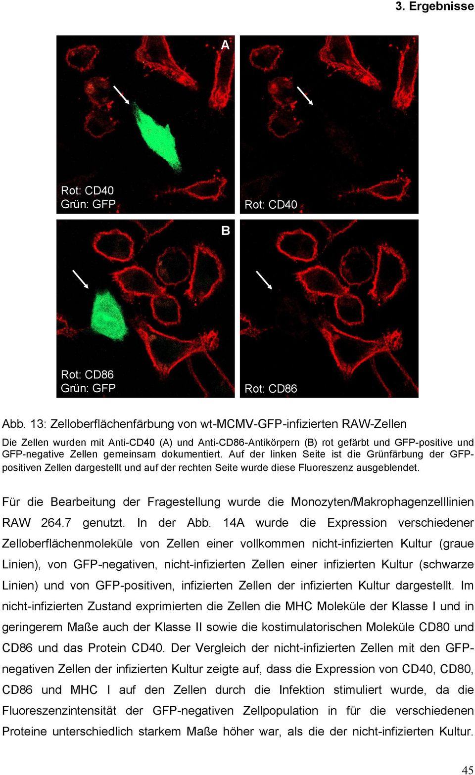 Auf der linken Seite ist die Grünfärbung der GFPpositiven Zellen dargestellt und auf der rechten Seite wurde diese Fluoreszenz ausgeblendet.