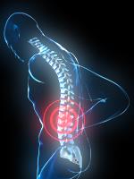 Rückenschmerzen Wahrscheinlichkeit, im Laufe des Lebens an Rückenschmerzen zu erkranken 70-90 % 80-90 % aller Rückenschmerzen klingen innerhalb von