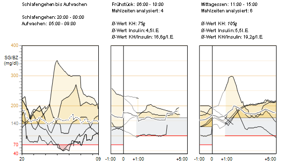 Glukoseübersicht (Nachtruhe und Mahlzeiten) Messwerte & Mittelwerte Nachtruhe Diese Grafik kombiniert die Sensorverlaufskurven während der Nachtruhe für alle Tage des Berichtszeitraums, an denen ein