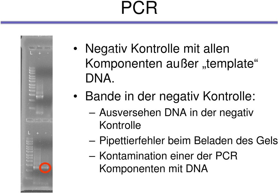 Kontrolle: Ausversehen DNA in der negativ Kontrolle