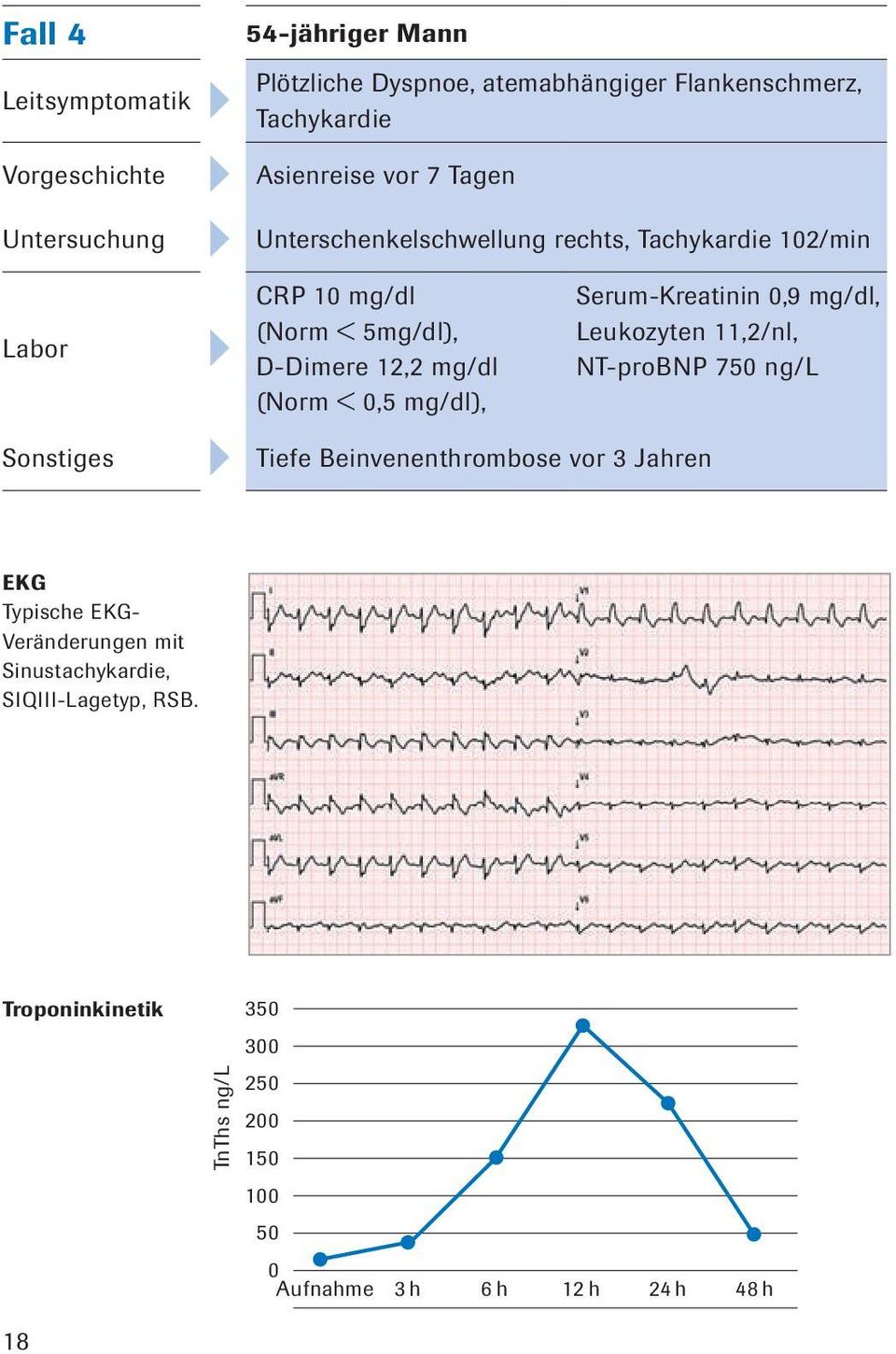Serum-Kreatinin 0,9 mg/dl, Leukozyten 11,2/nl, NT-proBNP 750 ng/l Sonstiges Tiefe Beinvenenthrombose vor 3 Jahren EKG Typische EKG-