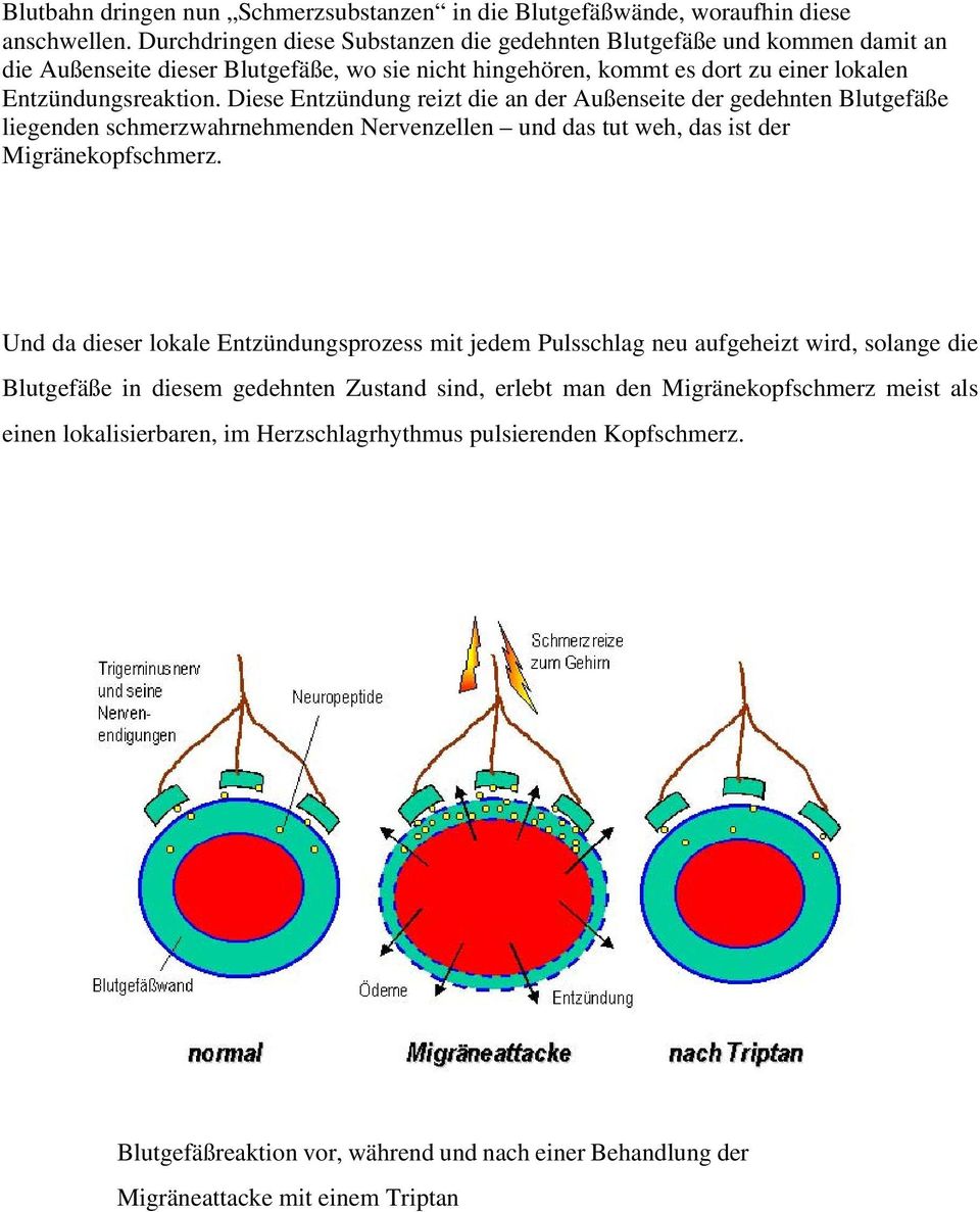 Diese Entzündung reizt die an der Außenseite der gedehnten Blutgefäße liegenden schmerzwahrnehmenden Nervenzellen und das tut weh, das ist der Migränekopfschmerz.