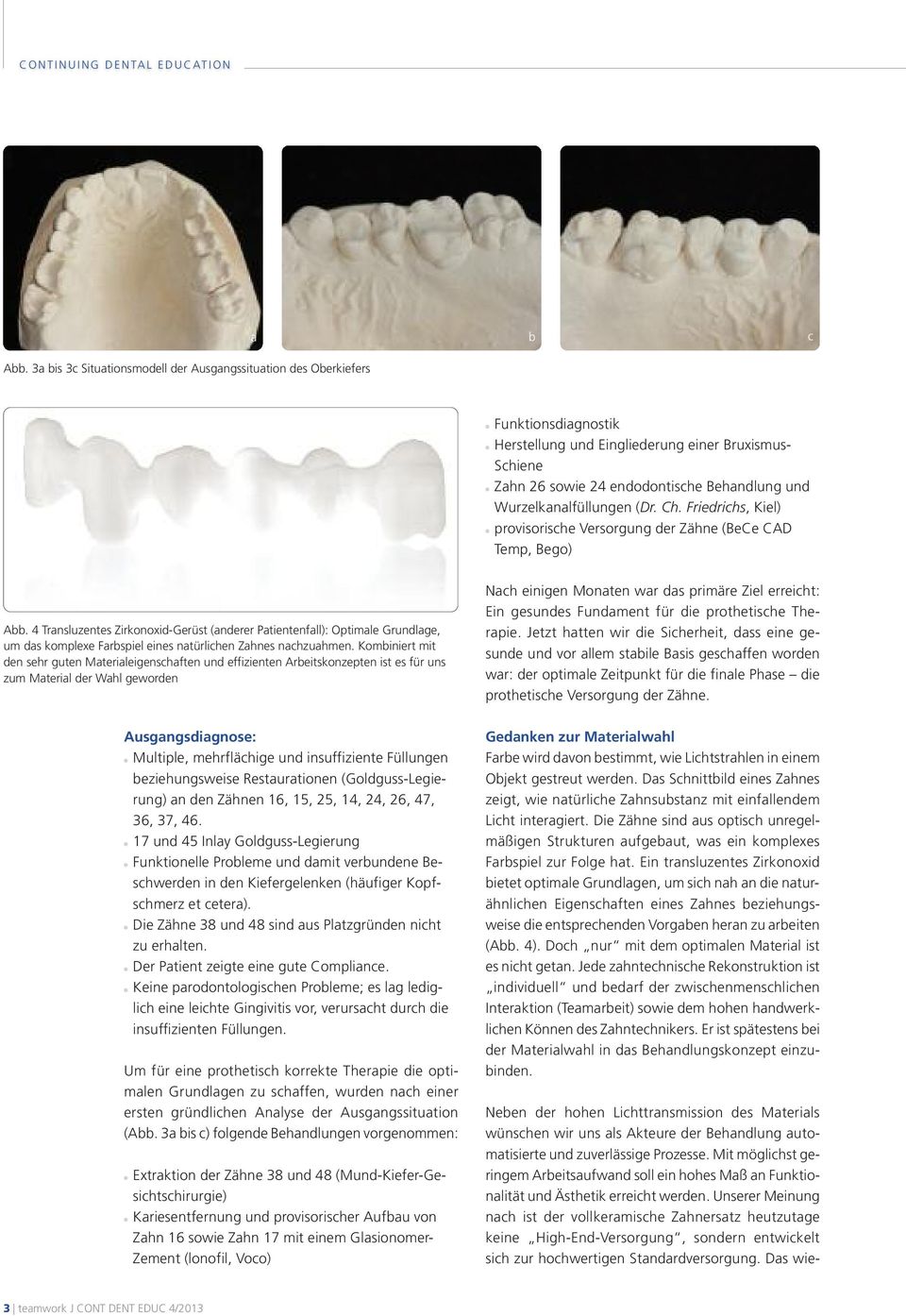 4 Transluzentes Zirkonoxid-Gerüst (anderer Patientenfall): Optimale Grundlage, um das komplexe Farbspiel eines natürlichen Zahnes nachzuahmen.