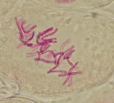 Chromosom in Chromatiden gespalten; rot: Telomeren.