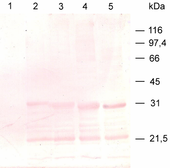 Ergebnisse 26 Selektion der Kolonien mit der entsprechenden Antibiotikum-Resistenz wurde die aus den Bakterien isolierte DNA auf ihre Richtigkeit untersucht (siehe Abb. 27).