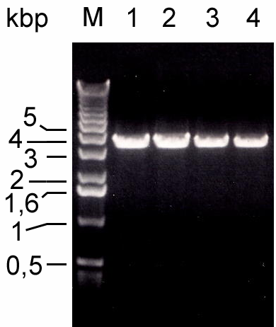 Ergebnisse 35 Abbildung 37: Expressionsversuch mit den 7-Konstrukten unter veränderten Bedingungen. SDS-PAGE und ein Teil des Western-Blots der Proteine aus den Expressionsversuchen.