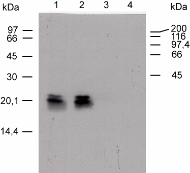 Ergebnisse 23 testet. Hier wurde allerdings kein exprimiertes Schleifen-Protein gefunden.