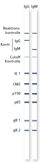 recomline CMV - Bewertung der Avidität p150 IE1 CM2 gb2 Interpretation (I) (II) Anitkörper mit hoher Avidität im p150 und zusätzlich Antikörper mit hoher Avidität gegenüber einem weiteren