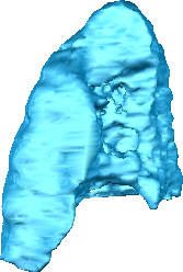 85 H P R L A F Abbildung 3.29: Ergebnis der Segmentierung des rechten Lungenflügels Abgebildet ist das Ergebnis der Segmentierung des rechten Lungenflügels mit Hilfe des Random-Walker Verfahrens.