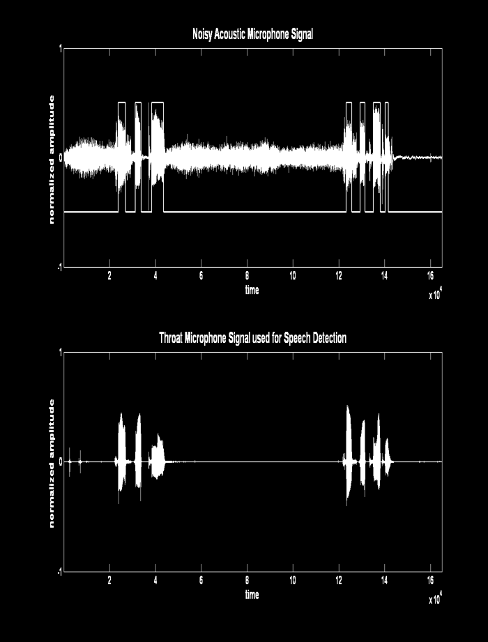 Detektion aktiver Signalabschnitte Dynamisch veränderliche Hintergrundgeräusche erschweren die Unterscheidung zwischen relevanten