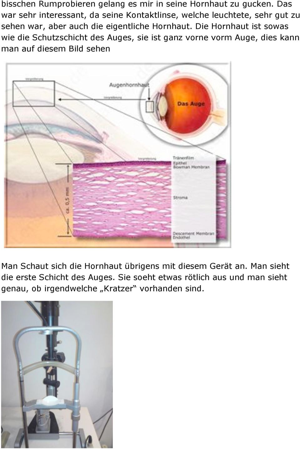 Die Hornhaut ist sowas wie die Schutzschicht des Auges, sie ist ganz vorne vorm Auge, dies kann man auf diesem Bild sehen