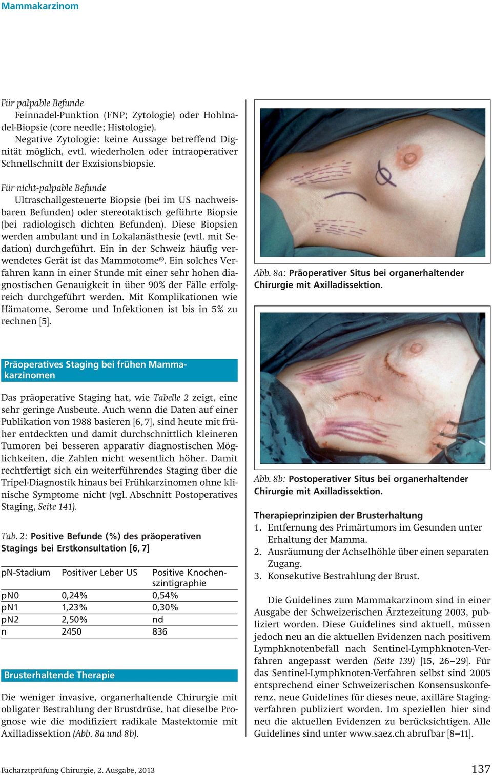 Für nicht-palpable Befunde Ultraschallgesteuerte Biopsie (bei im US nachweisbaren Befunden) oder stereotaktisch geführte Biopsie (bei radiologisch dichten Befunden).