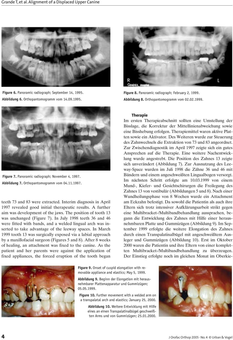 Interim diagnosis in April 1997 revealed good initial therapeutic results. A further aim was development of the jaws. The position of tooth 13 was unchanged (Figure 7).