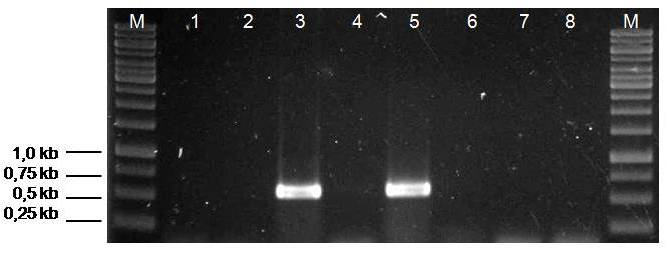 Ergebnisse Abbildung 4.11: Überprüfung des keimarmen Hackfleisches (HF) auf STEC mittels PCR am Beispiel des stx 2.