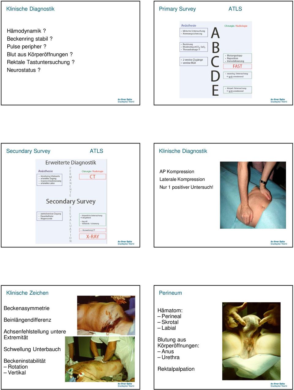 Secundary Survey ATLS Klinische Diagnostik AP Kompression Laterale Kompression Nur 1 positiver Untersuch!