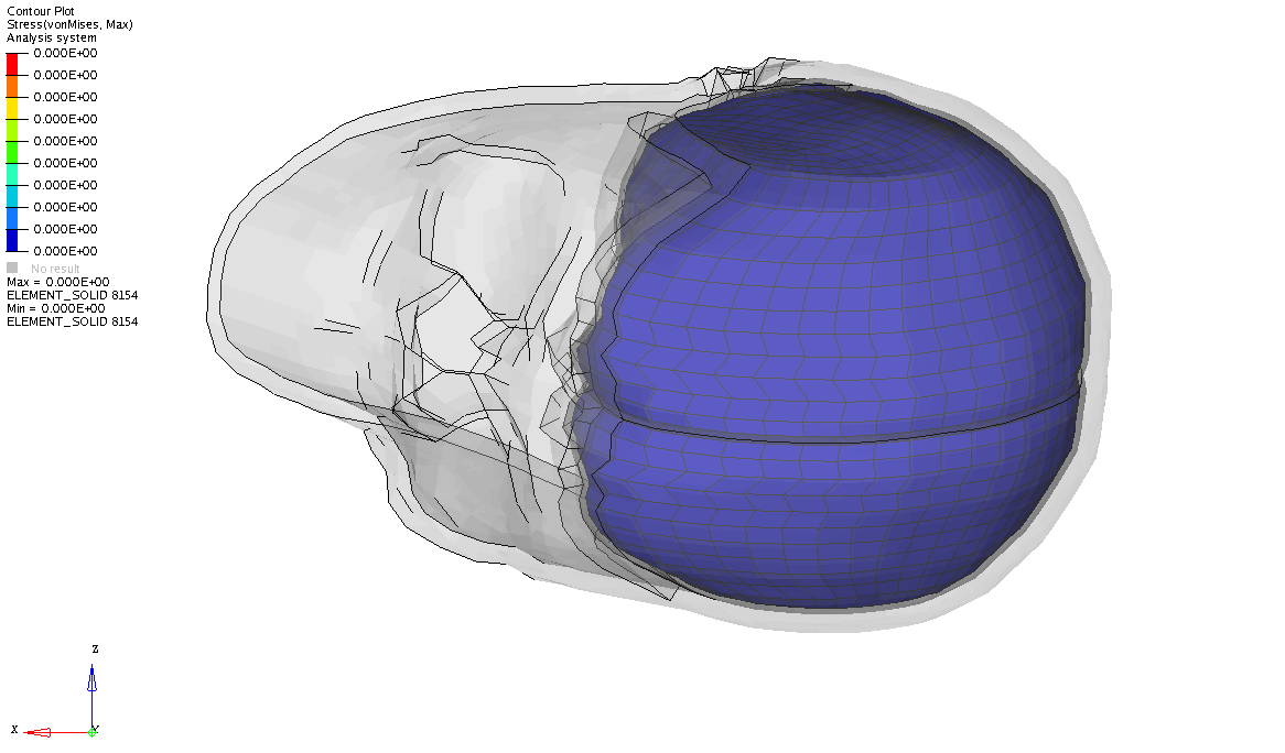 18 FE-Simulationen mit Kopf- und Helmmodell FE-Simulation Beispiel: Alleinunfall,