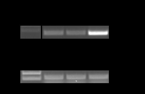 (B) Als Primer wurden Atnad2ab-16/Atnad2ab-15 verwendet (P2 + P3, Abbildung 6), wobei ein 61 bp großes DNA-Fragment amplifiziert wird. Weitere Erläuterungen siehe Abbildung 15B.