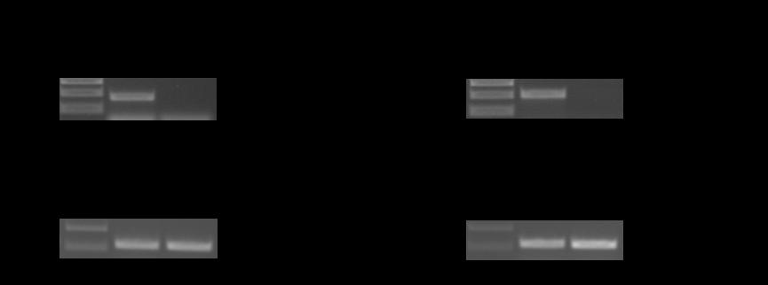der Insertionsort durch die Primer flankiert (SALK071821, SALK094849) wird (Abbildung 32). Bei Col kann bei der RT-PCR auf At5g09840.