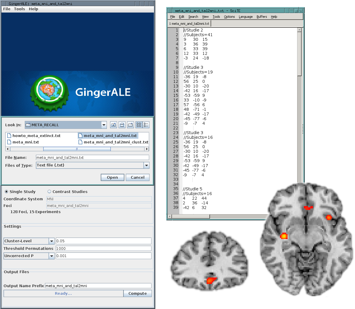 BrainMap GingerAle Activation Likelihood Estimation Koordinatenlisten werden mit