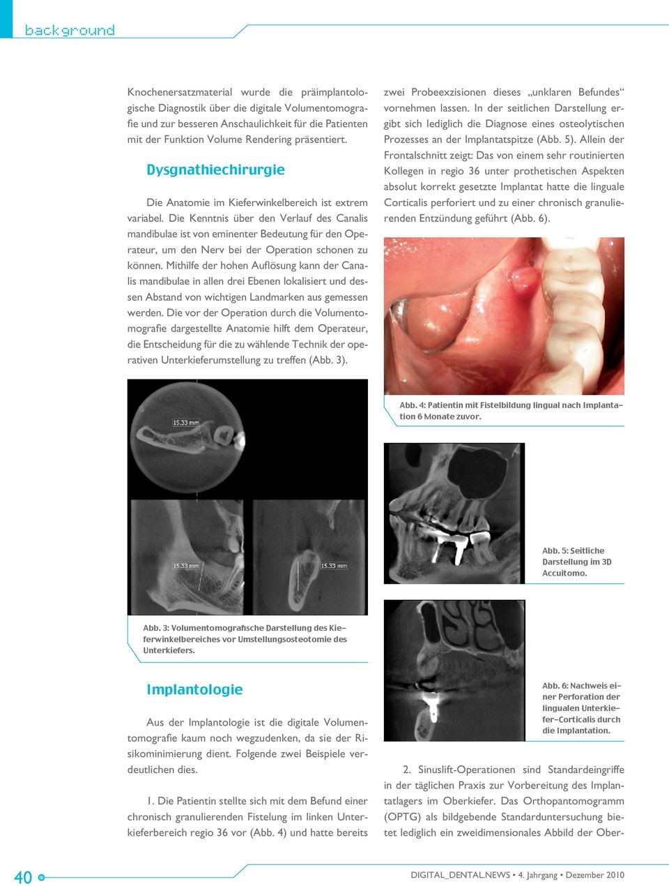 Die Kenntnis über den Verlauf des Canalis mandibulae ist von eminenter Bedeutung für den Operateur, um den Nerv bei der Operation schonen zu können.