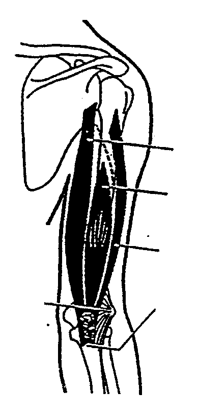 M. triceps brachii B C langer Kopf/ caput longum () Höckerchen unterhalb der Schultergelenkpfanne am Schulterblatt (tuberculum infraglenoidale scapulae) kurze Köpfe/