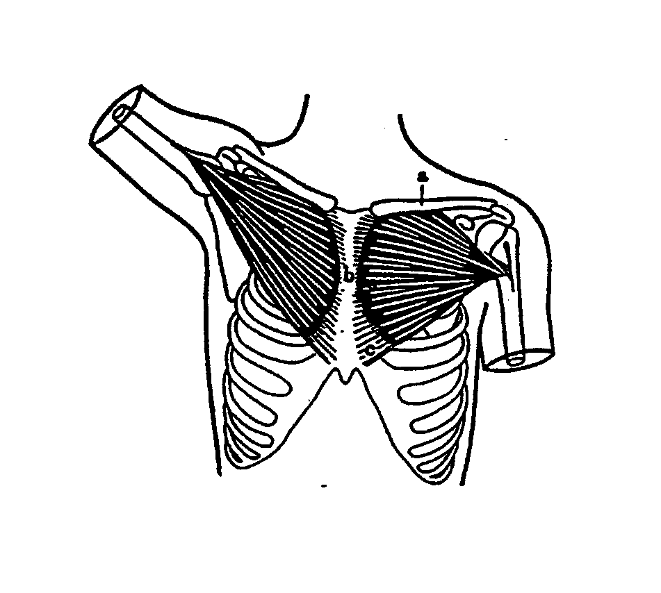 M. pectoralis major B C pars clavicularis () Schlüsselbein (calvicula), absteigender Faserverlauf pars sternocostalis (B) Brustbein (sternum), quer verlaufender Faserverlauf pars abdominalis