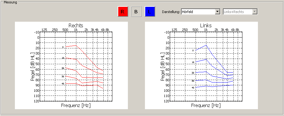 Bei der Auswahl dieses Menüeintrags werden die Parameter der Lautheitsfunktion als Textzeile in die Zwischenablage kopiert.