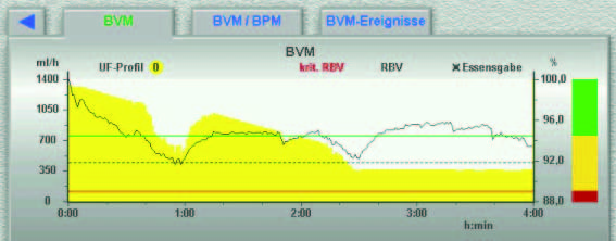 b) Regelung der Ultrafiltration durch den BVM Einführung Die kontinuierliche Messung des RBV kann genutzt werden, um die Blutvolumenreduktion in einem für den Patienten verträglichen Rahmen zu halten.