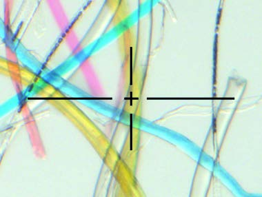 Effektiv abgebildeter Ausschnitt Bedingt durch die Sensorgröße im Mikroskop, zeigen das Livebild am HD-Bildschirm und das endgültig aufgezeichnete Bild nicht den selben Ausschnitt. 1.