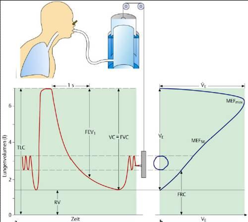 Die Spirometrie umfasst als Bestandteil der Bodyplethysmographie die Bestimmung der statischen (TLC, RV) und dynamischen (FEV0,5, FEV1, PEF, MEF25-75) Lungenvolumina.