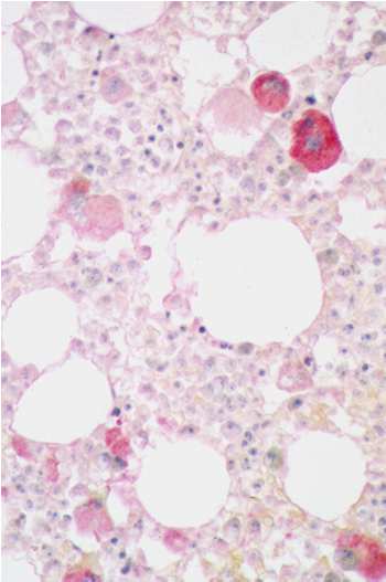 Routinemarker für die Immunhistologie Myeloische Zellen Myeloperoxidase (MPO) CD43 (MT1) Lysozym CD15, CD33 Erythropoiese Megakaryozyten CD61 CD42, CD31 Monozyten / Makrophagen Blasten /