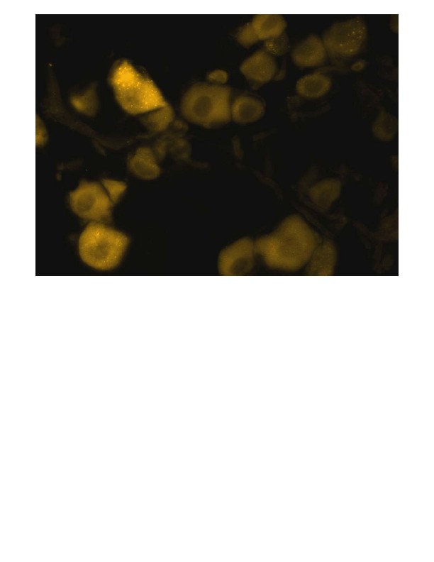 Abbildung 13 : SP Immunhistochemie Bilder Abbildung einiger Ganglionzellen mit einem deutlich starken Signal