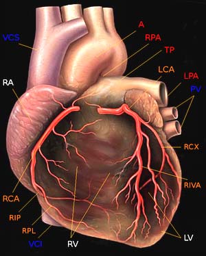 Blutversorgung - Herzkranzgefäße A. coronaria dextra (RCA = right coronary artery) aus dem Sinus aortae dexter, verläuft zwischen r. Herzohr (bedeckt sie) und dem Tr.