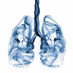 MEDIZIN SERVICE Lungenkrebs: Neues Medikament gegen Resistenzen Das nicht kleinzellige Lungenkarzinom ist die häufigste Form von Lungenkrebs.