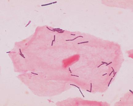 Lactobacillus Lactobacillus casei ist ein stäbchenförmiges grampositives Bakterium.