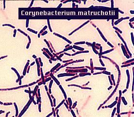 Corynebakterien Polymorphe, keulenförmige Stäbchen Grampositiv C. matruchotii C. durum Bestandteil von Plaque Fraglich pathogen http://www.medschool.lsuhsc.edu/microbiology/dmip/dmex15.