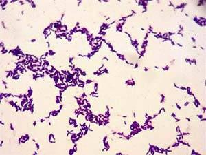 Propionibacterium acnes ist ein gram-positives kurzes, stäbchenförmiges Bakterium, auch ellipsoide Zellformen kommen vor. Eine einzelne Zelle ist 0,4 0,5 µm (Mikrometer) breit und 0,8 0,9 µm lang.