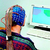 Hierbei wird eine mit Elektroden bestücke 'Thinkcap' dem Patienten aufgesetzt, mit der dann direkt von der Kopfhaut die Signale abgelesen werden.