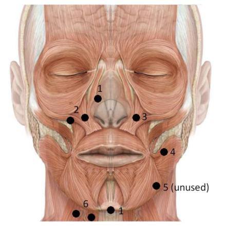 Sprechen ist Aktivität der Gesichtsmuskeln Was für den Arm geht, geht auch im Gesicht Sprechen durch Bewegen der Gesichtsmuskeln Wir kleben die Elektroden ins Gesicht, um die