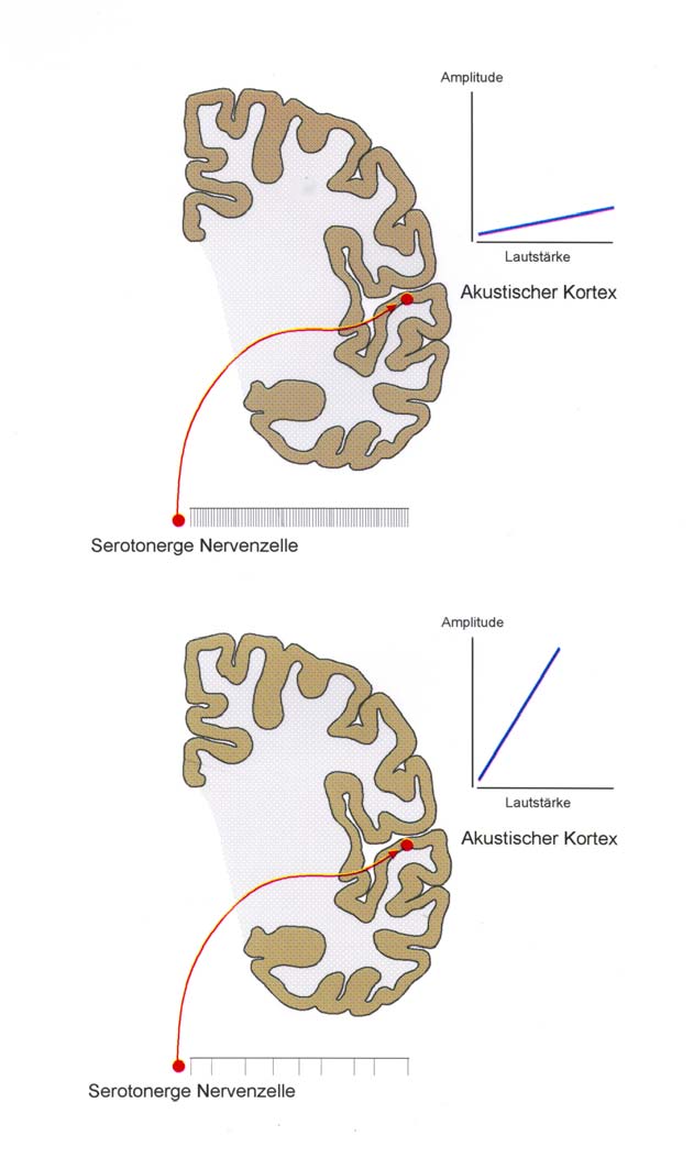 Lautstärkeabhängigkeit akustisch evozierter Potentiale (LAAEP) als Indikator des synaptisch freigesetzten